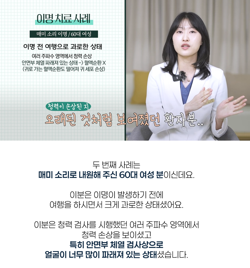 귀에서 삐소리 12