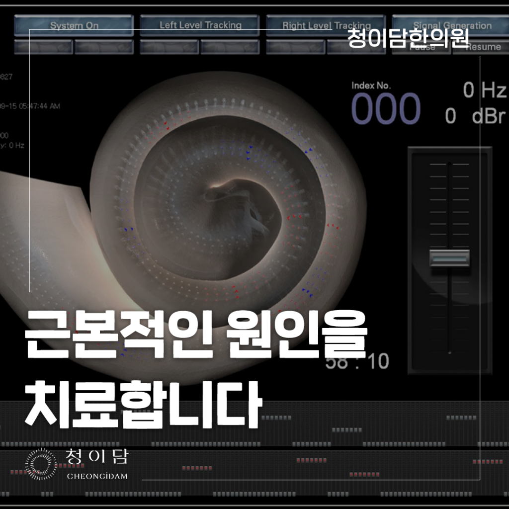 귀에서 삐소리 이유